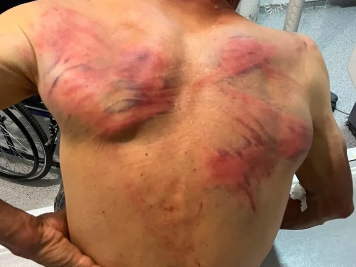 Foto: Tzv. kosovska policija pretukla Nenada Raškovića